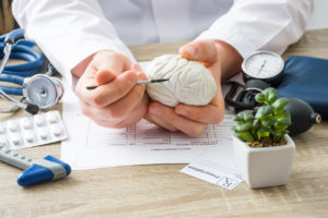 How Hawk Law Group Can Help With a Brain Injury Claim in Evans, GA